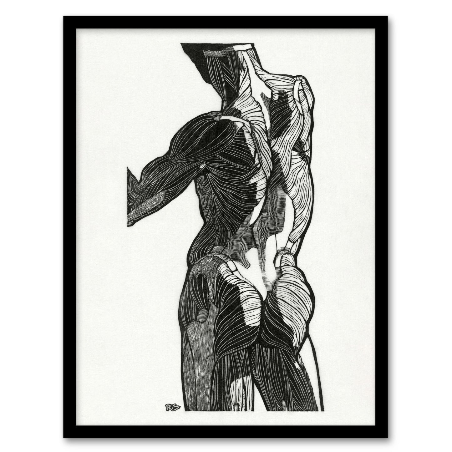 Reijer Stolk Anatomical Study Of Gluteal Muscles Framed Wall Art Print